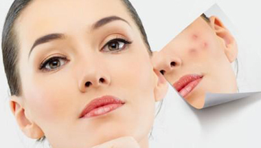 选择专业的祛痘品牌加盟最要关注哪些内容？